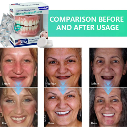 🔥Limited Time 50% OFF： 2nd ltem 60% Off🔥Acezozla® Medical Full Denture with Strong Suction ✅ Made and Shipped from the USA🍀