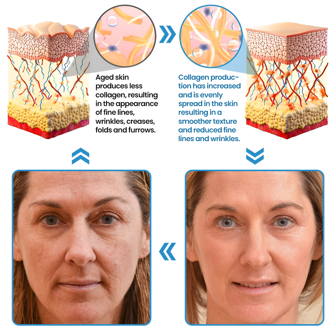Acezozla® Collagen Peptide Serum