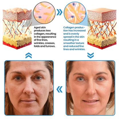 Acezozla® Collagen Peptide Serum