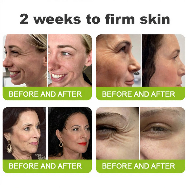 🧠👨‍⚕️Made and shipped from the USA 💫ACEZOZLA® Skin Tightening & Vita-A Retinol Retinol shot Anti-Wrinkle Firming Tightening cream - Last Day Promotion 70% OFF