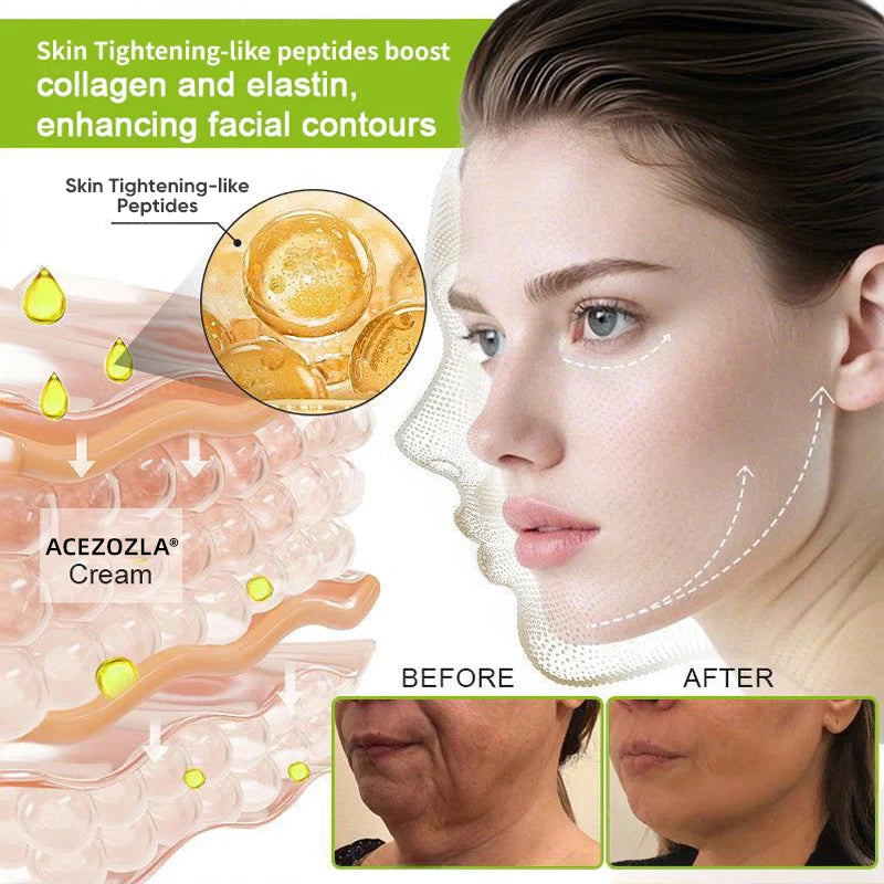🧠👨‍⚕️Made and shipped from the USA 💫ACEZOZLA® Skin Tightening & Vita-A Retinol Retinol shot Anti-Wrinkle Firming Tightening cream - Last Day Promotion 70% OFF