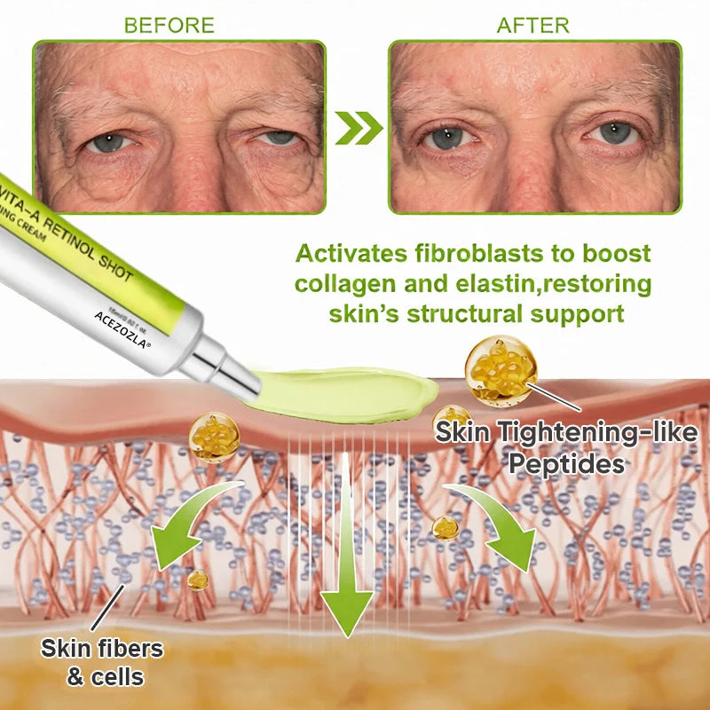 🧠👨‍⚕️Made and shipped from the USA 💫ACEZOZLA® Skin Tightening & Vita-A Retinol Retinol shot Anti-Wrinkle Firming Tightening cream - Last Day Promotion 70% OFF