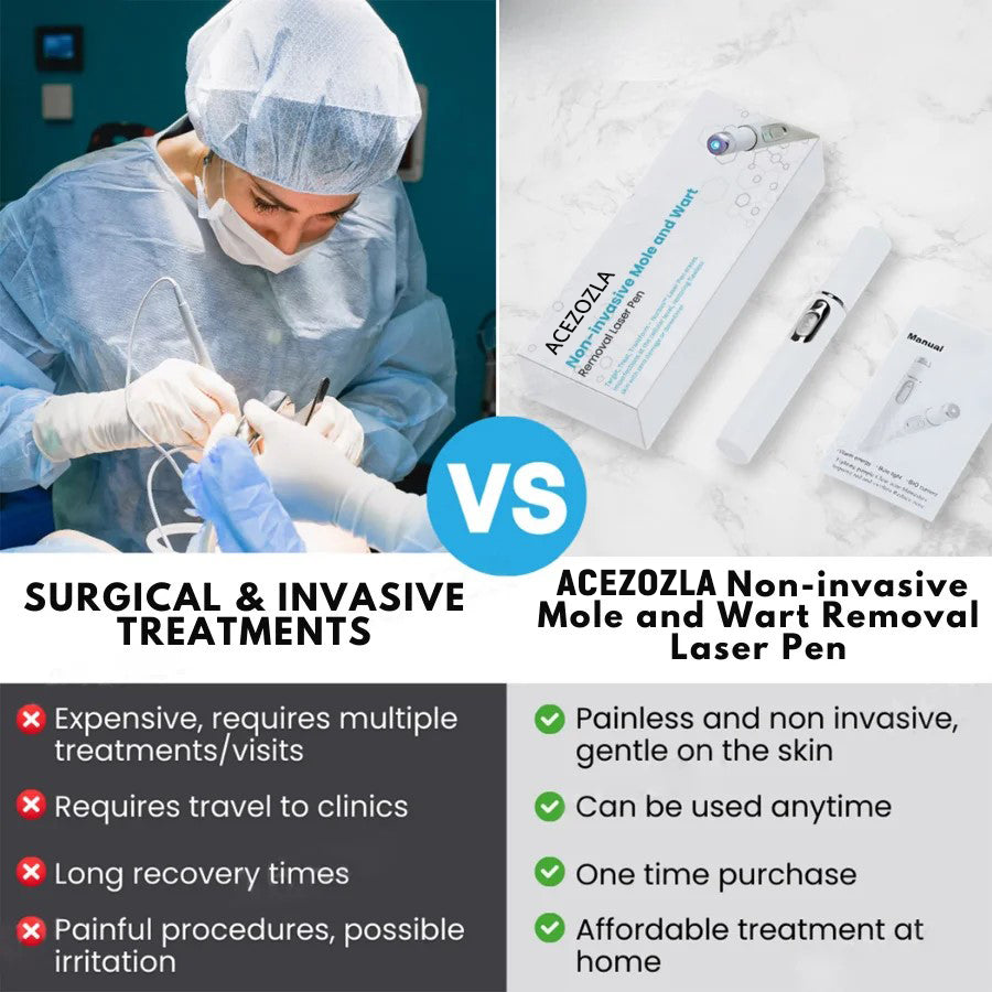 🔥 Erase Moles & Skin Tags in Days! ACEZOZLA™ Non-Invasive Laser Pen – Hospital-Grade, Safe & Painless ✨