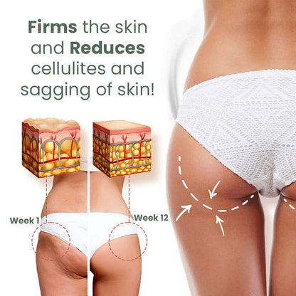 Artemisia Cream for Fat Burning & Firming